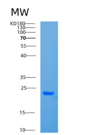 Recombinant Human CBX3 Protein,Recombinant Human CBX3 Protein