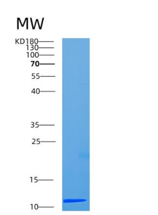 Recombinant Human CCDC23 Protein,Recombinant Human CCDC23 Protein