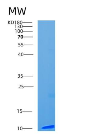 Recombinant Human CCL13 Protein,Recombinant Human CCL13 Protein