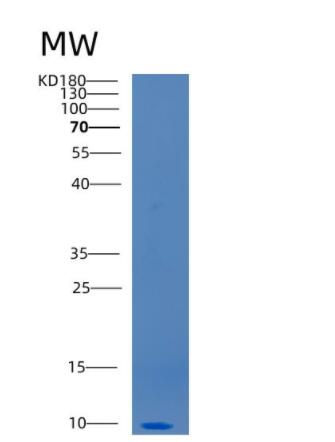 Recombinant Human CCL20 Protein,Recombinant Human CCL20 Protein