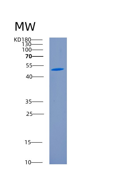 Recombinant Human CD226 Protein,Recombinant Human CD226 Protein