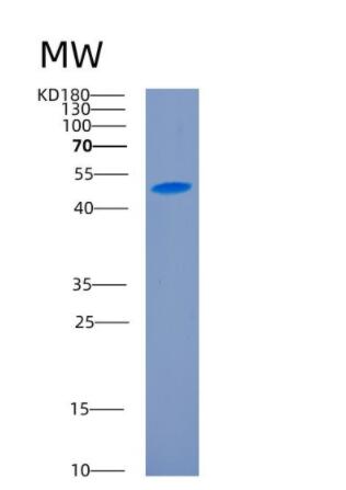 Recombinant Human CD27 Protein,Recombinant Human CD27 Protein