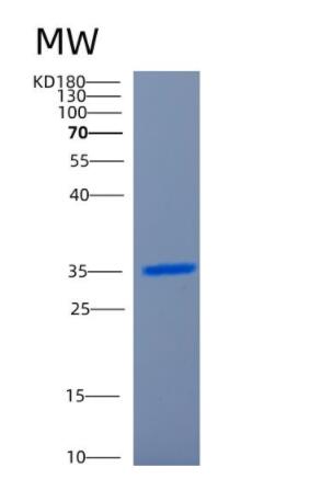 Recombinant Human CCND2 Protein,Recombinant Human CCND2 Protein