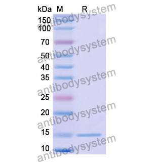 抗 Human CFTR 纳米抗体 (SAA1020)(RHC98305),Anti-Human CFTR Nanobody (SAA1020)