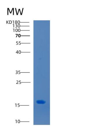 Recombinant Mouse CCL2 Protein,Recombinant Mouse CCL2 Protein