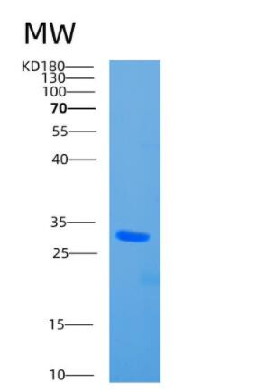 Recombinant Human CBR4 Protein,Recombinant Human CBR4 Protein