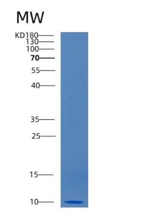 Recombinant Human CCL3 Protein,Recombinant Human CCL3 Protein