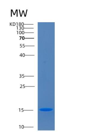 Recombinant Human CD160 Protein,Recombinant Human CD160 Protein