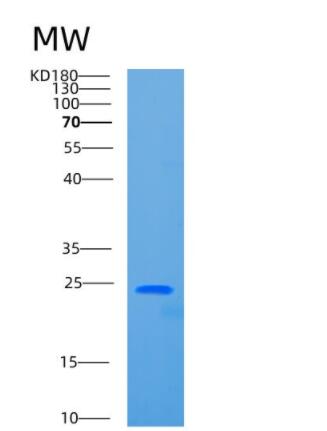 Recombinant Human CBX5 Protein,Recombinant Human CBX5 Protein