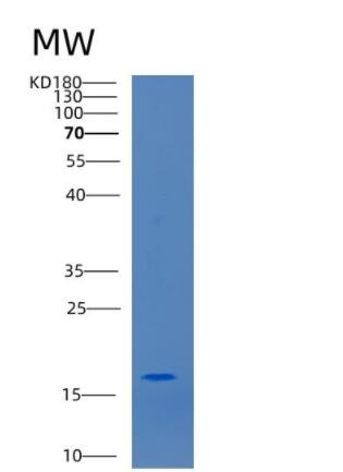Recombinant Human CCL25 24-150aa Protein,Recombinant Human CCL25 24-150aa Protein