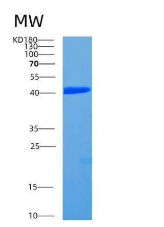 Recombinant Human CCDC104 Protein,Recombinant Human CCDC104 Protein