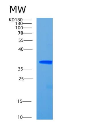 Recombinant Human CCDC69 Protein,Recombinant Human CCDC69 Protein