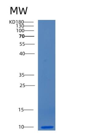 Recombinant Human CCL15 Protein,Recombinant Human CCL15 Protein