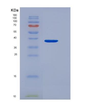 Recombinant CD300 Antigen Like Family Member C (CD300c),Recombinant CD300 Antigen Like Family Member C (CD300c)