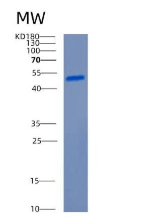 Recombinant Human CCNB1 Protein,Recombinant Human CCNB1 Protein