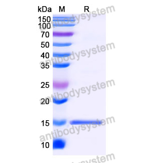 抗 SARS-CoV-2 S Protein 纳米抗体 (SAA0970)(RVV00135),Anti-SARS-CoV-2 S Protein Nanobody (SAA0970)