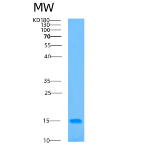 Recombinant Human B2M Protein,Recombinant Human B2M Protein