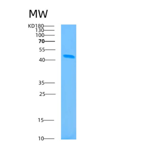 Recombinant Human B3GNT2 Protein