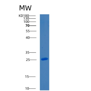 Recombinant Mouse Bcl-2-like-protein 1 Protein,Recombinant Mouse Bcl-2-like-protein 1 Protein