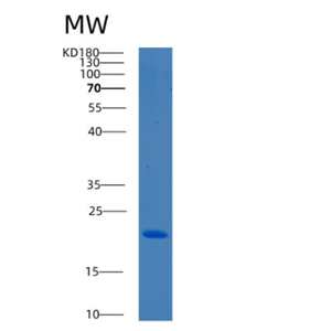 Recombinant Human BCL2L10 Protein,Recombinant Human BCL2L10 Protein