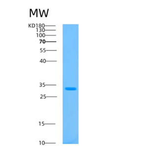 Recombinant Human ATP5C1 Protein,Recombinant Human ATP5C1 Protein