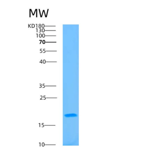 Recombinant Human BAALC Protein