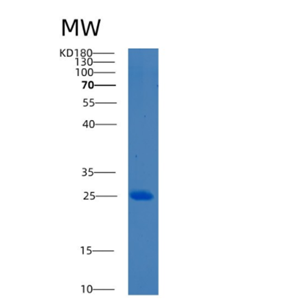 Recombinant Human BCL7C Protein,Recombinant Human BCL7C Protein