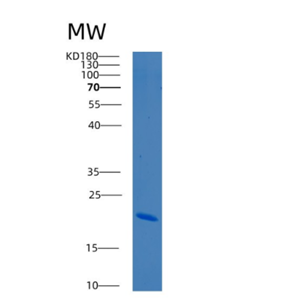 Recombinant Human BCL2L2 Protein,Recombinant Human BCL2L2 Protein