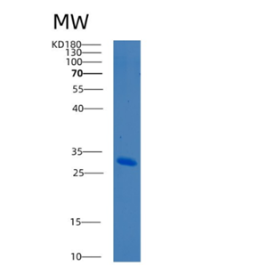 Recombinant Human BCL10 Protein