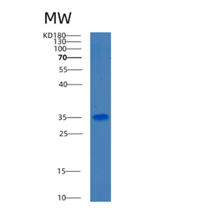 Recombinant Human BDH1 Protein,Recombinant Human BDH1 Protein