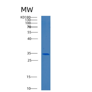 Recombinant Human BEND6 Protein,Recombinant Human BEND6 Protein