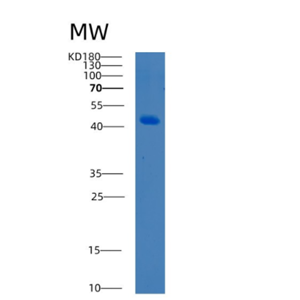 Recombinant Human BCAT2 Protein,Recombinant Human BCAT2 Protein