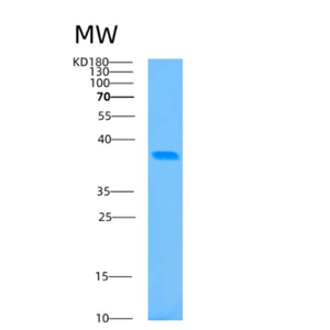 Recombinant Human BABAM1 Protein,Recombinant Human BABAM1 Protein