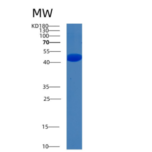 Recombinant Human BHMT2 Protein