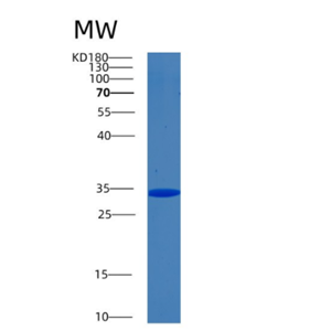 Recombinant Human Biliverdin reductase A Protein