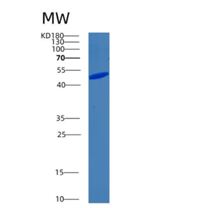 Recombinant Human BIN1 Protein