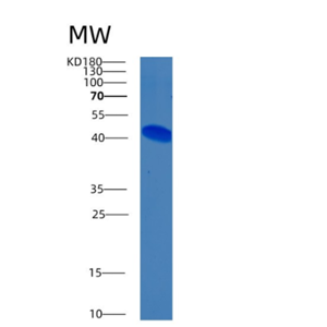 Recombinant Human BMPR1A Protein