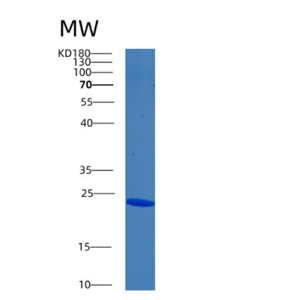 Recombinant Human Biliverdin reductase B Protein