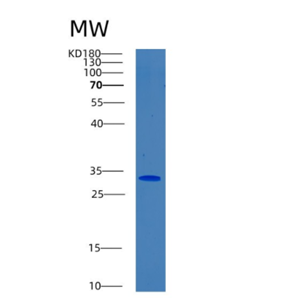 Recombinant Human BPGM Protein,Recombinant Human BPGM Protein