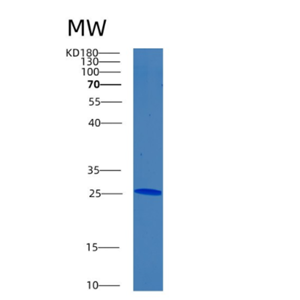 Recombinant Human BNIP1 Protein,Recombinant Human BNIP1 Protein