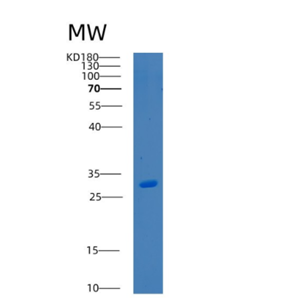 Recombinant Human BSND Protein,Recombinant Human BSND Protein