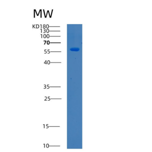 Recombinant Human BTD Protein