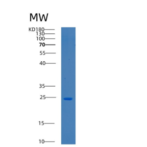 Recombinant Human BTF3 Protein