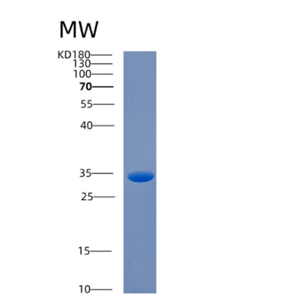 Recombinant Human CA8 Protein