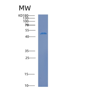 Recombinant Human Calreticulin Protein,Recombinant Human Calreticulin Protein