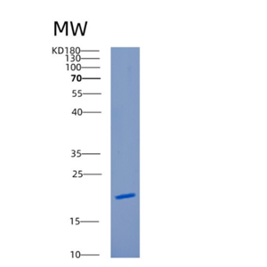 Recombinant Human CAMP Protein,Recombinant Human CAMP Protein