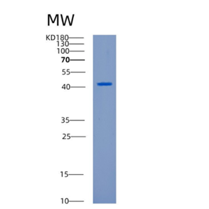 Recombinant Human CANT1 Protein,Recombinant Human CANT1 Protein