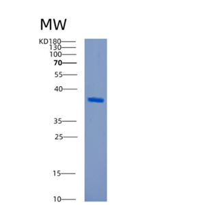 Recombinant Human CAPG Protein