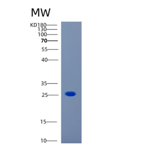 Recombinant Human CAPSL Protein