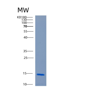 Recombinant Human CARD17 Protein